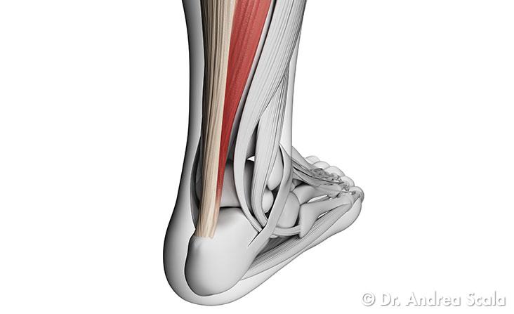 Trapianto del Tendine D'Achille