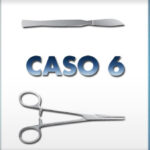 Chirurgia della Patologia di Alluce Valgo