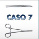 Chirurgia Alluce Valgo