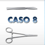 Alluce Valgo dopo l'intervento