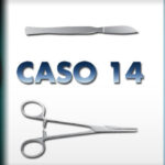 Alluce Valgo Risultati