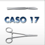 allucevalgo_caso17
