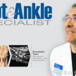 La chirurgia dell'alluce valgo del dott. Andrea Scala