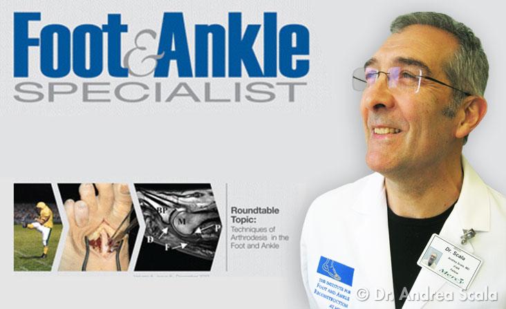 La chirurgia dell'alluce valgo del dott. Andrea Scala