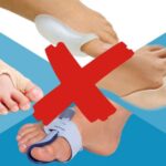 rimedi per alluce valgo a confronto