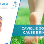 caviglie gonfie: cause