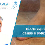 Molla di codivilla e piede equino