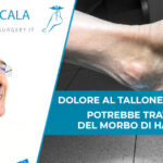 dolore tallone