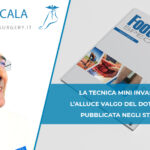 Modified Minimal Incision Subcapital Osteotomy for Hallux Valgus Correction