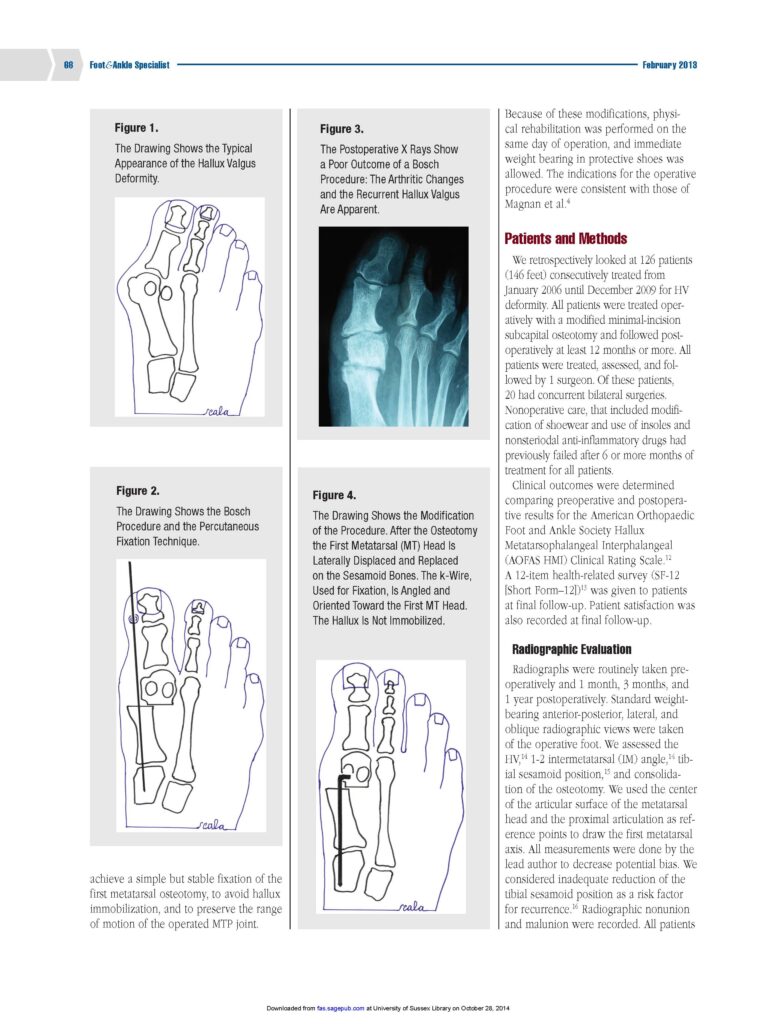 chirurgia mini-invasiva alluce valgo
