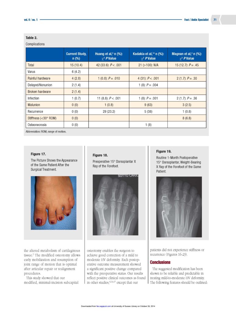 chirurgia mini-invasiva alluce valgo