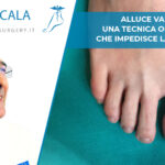 intervento alluce valgo