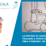 cover la protesi di caviglia ecologica