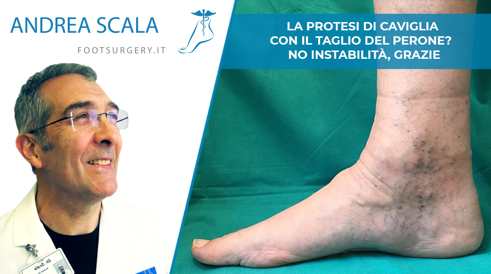 copertina-taglio-perone dott. Scala con caviglia in primo piano