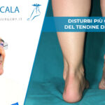 disturbi tendine di achille