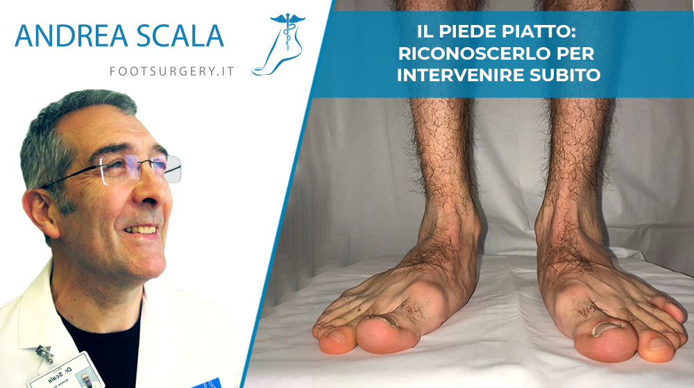 intervento piede piatto