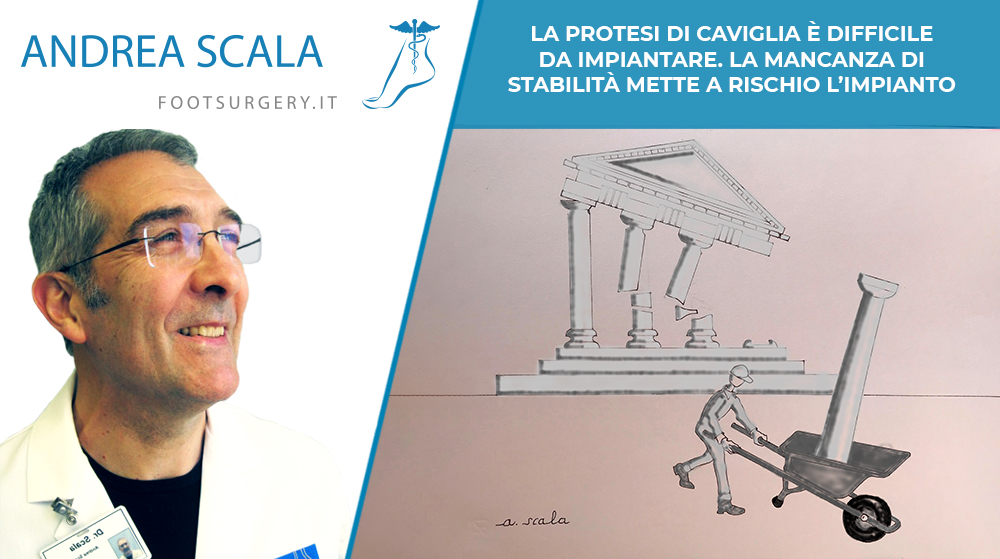 protesi di caviglia