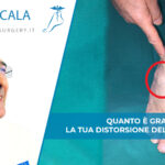 distorsione del piede