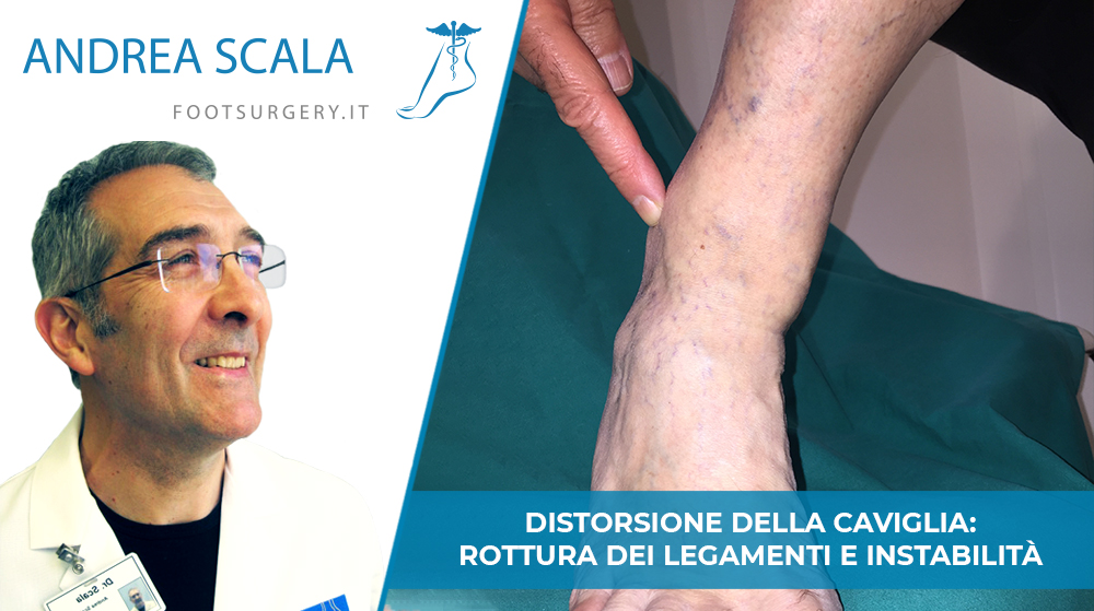 Distorsione della caviglia - Dott. Andrea Scala