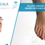 alluce valgo