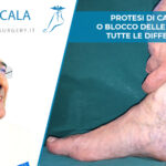 blocco della caviglia