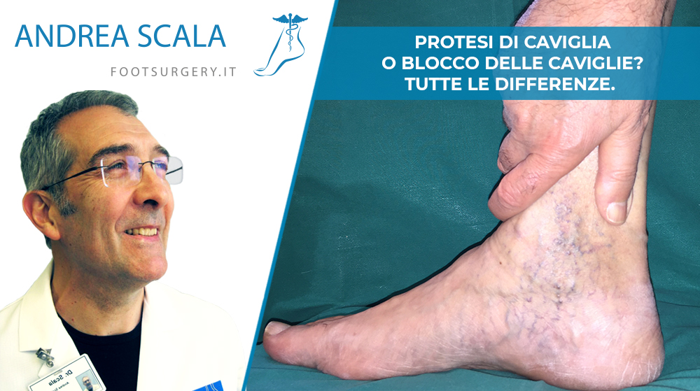 blocco della caviglia