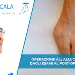 operazione alluce valgo