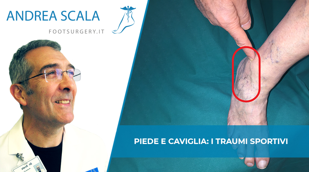 traumi sportivi piede caviglia