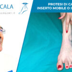 protesi di caviglia inserto