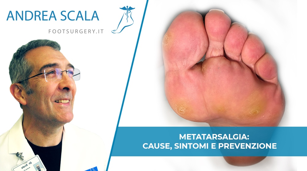 Metatarsalgia: cause, sintomi e prevenzione