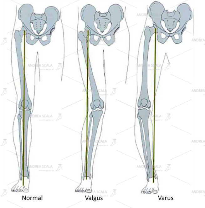 schema diversi quadri clinici dell’arto inferiore