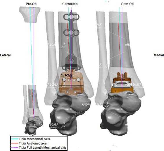schema sistema di allineamento