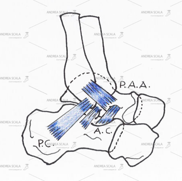 Distorsione della Caviglia