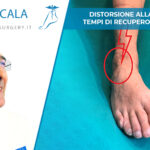 distorsione caviglia cosa fare