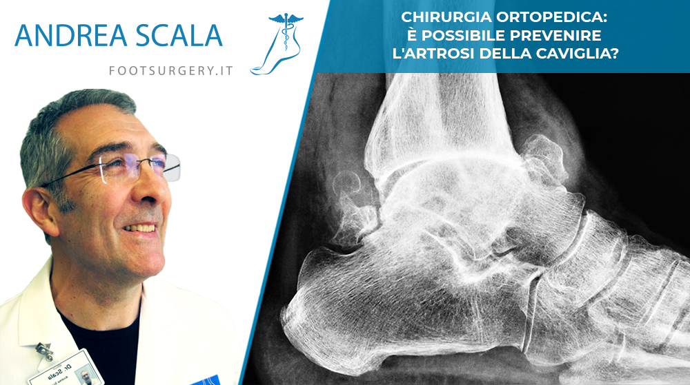 prevenzione artrosi caviglia