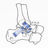 distorsione della caviglia