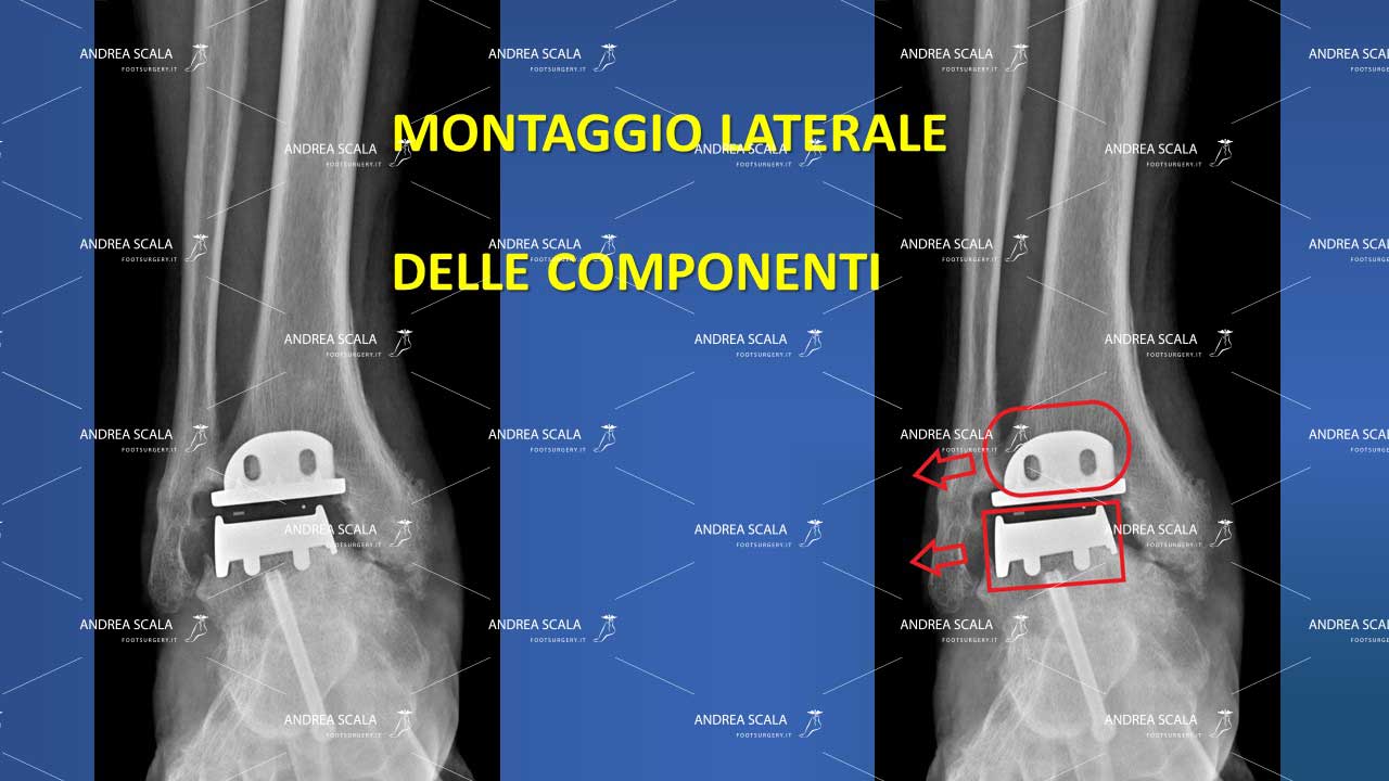 montaggio laterale componenti