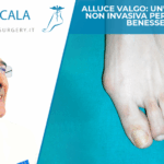 Alluce valgo: un'operazione non invasiva per ritrovare benessere