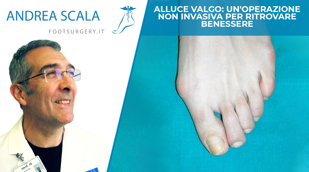 Alluce valgo: un'operazione non invasiva per ritrovare benessere