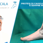 Protesi di caviglia: su misura è sempre meglio