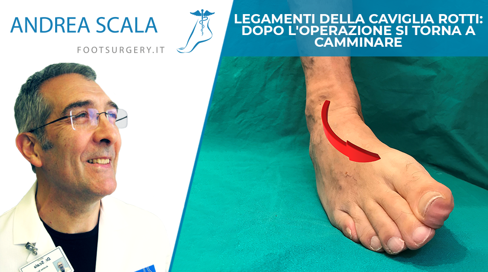 Legamenti della caviglia rotti: dopo l'operazione si torna a camminare