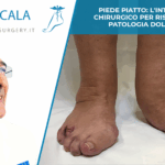 PIEDE PIATTO: L'INTERVENTO CHIRURGICO PER RISOLVERE LA PATOLOGIA DOLOROSA