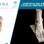 Chirurgia del piede e della caviglia: protesi e intervento