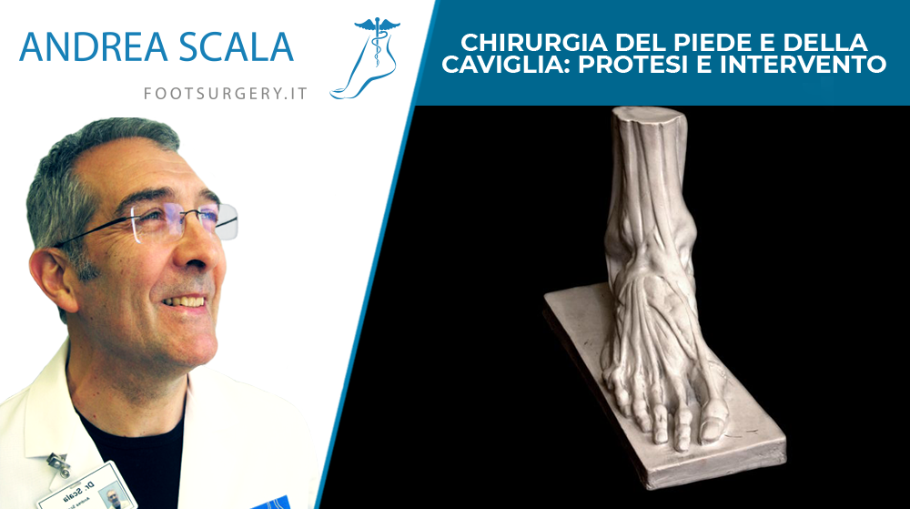 Chirurgia del piede e della caviglia: protesi e intervento