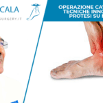 operazione caviglia