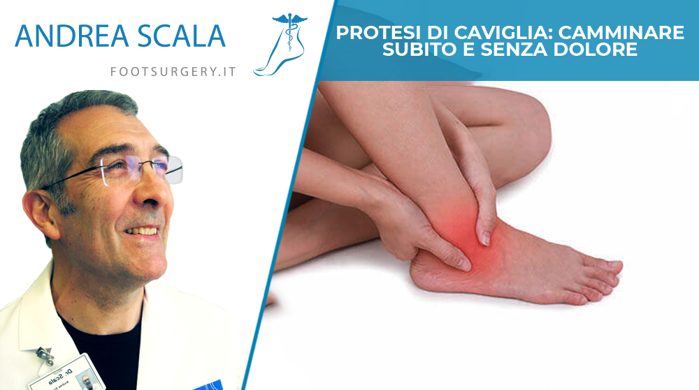 Protesi di caviglia