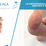 La metatarsalgia