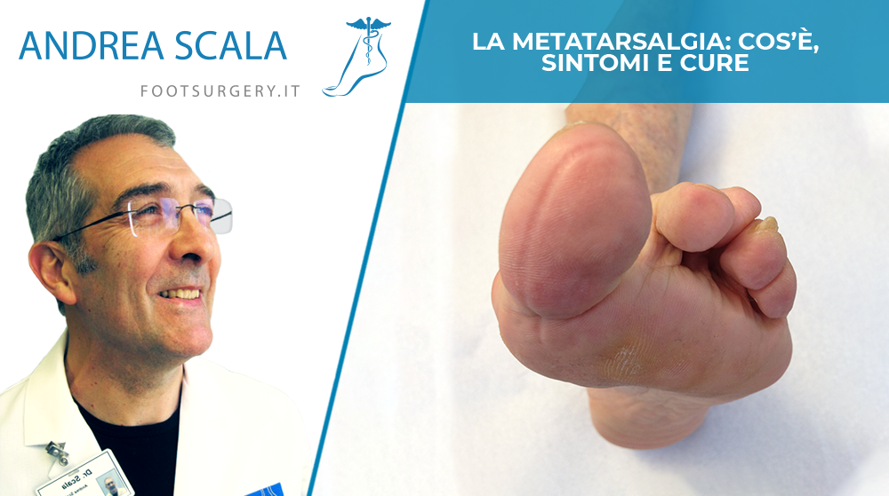 La metatarsalgia