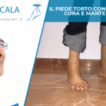 Piede congenito