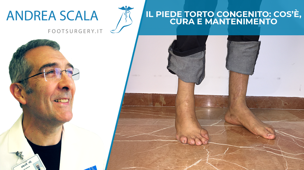 Piede congenito